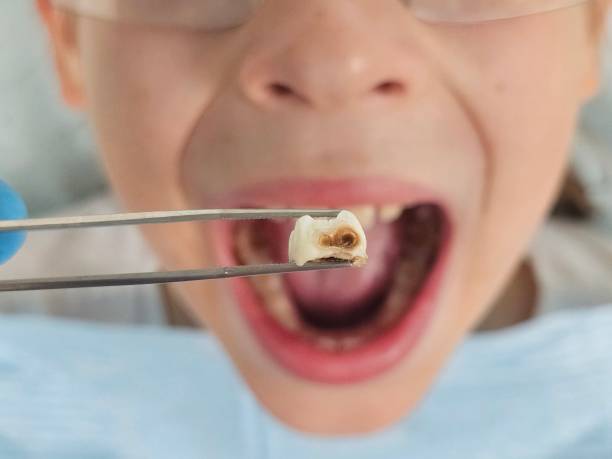 Best Pediatric Emergency Dentist in Hudson, FL